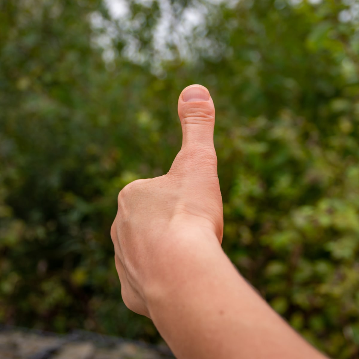 Webbed Toes And Clubbed Thumbs Celebrities With Physical