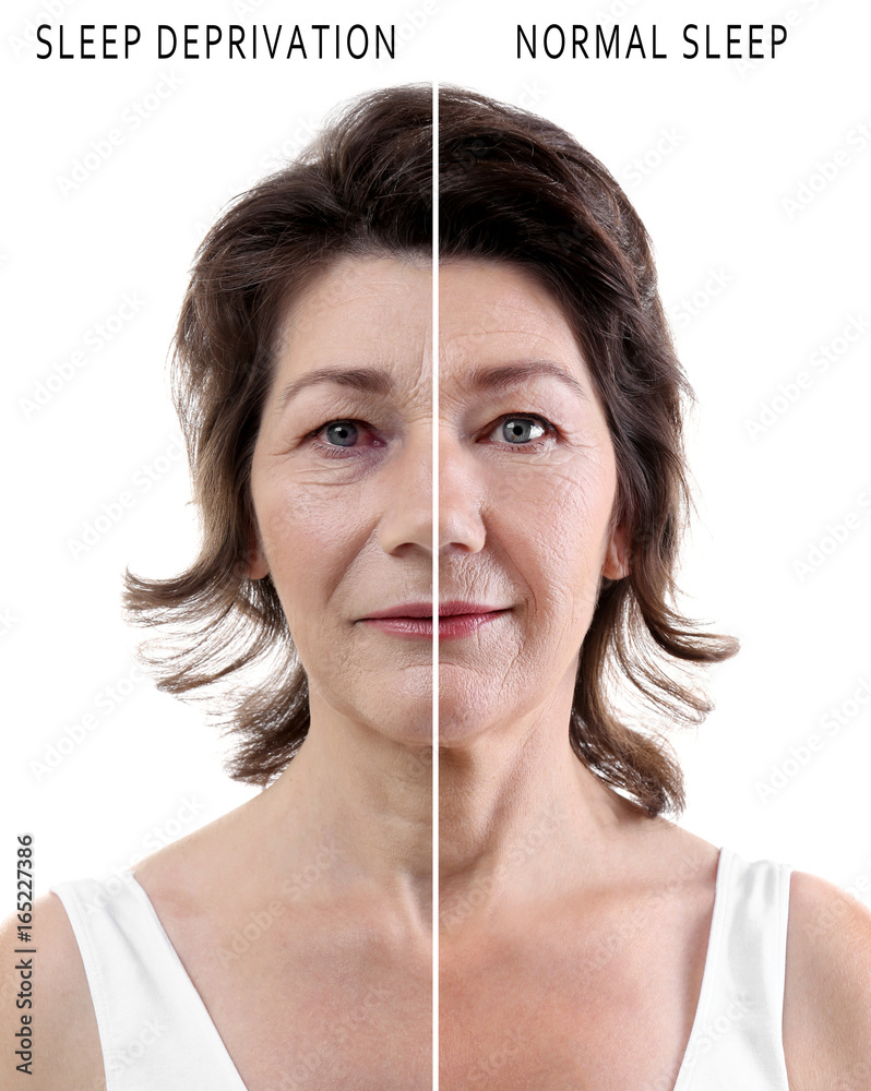 Sleep Deprivation Before And After