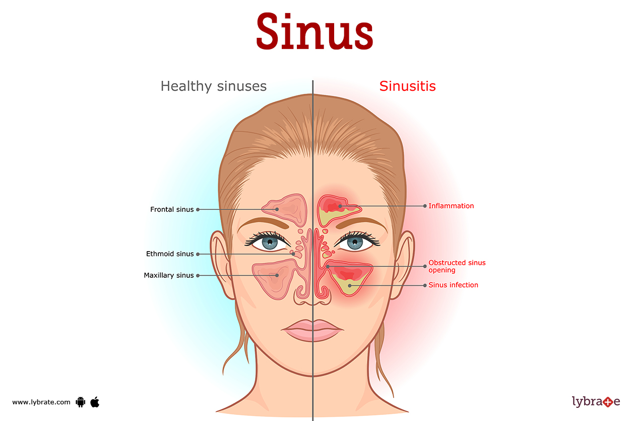 Sinus (Human Anatomy): Picture, Functions, Diseases, And Treatments
