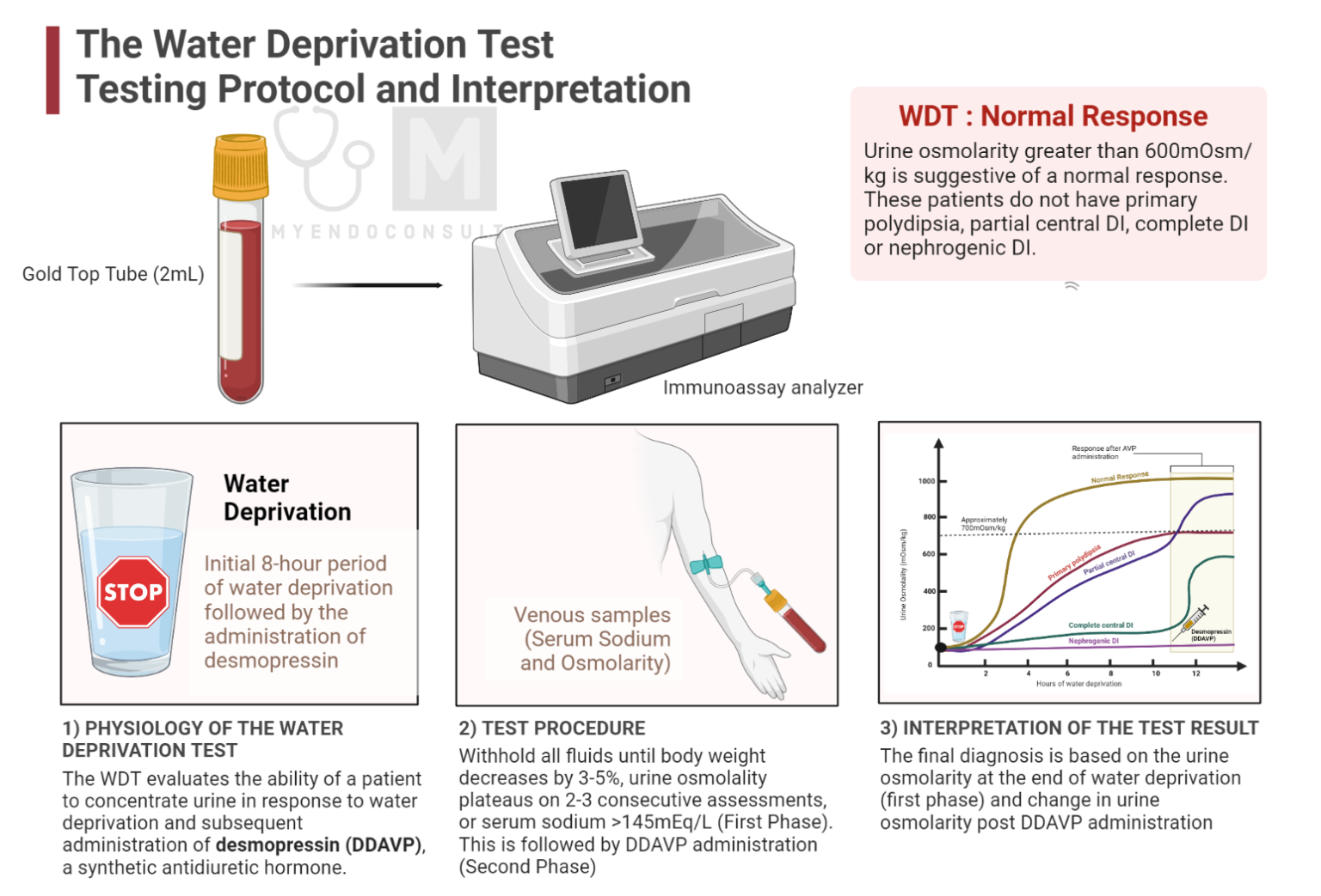 Water Deprivation Test – My Endo Consult