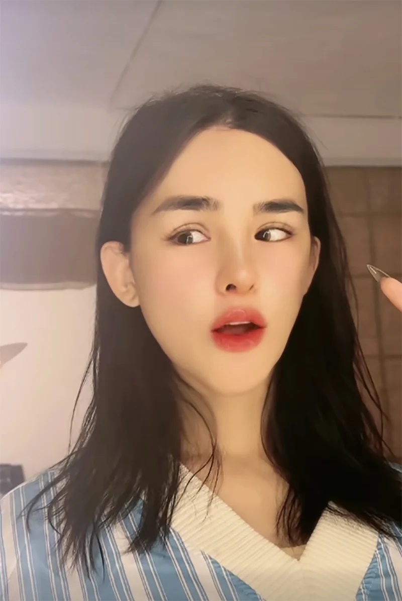 Tran Duc Bo Spent 1 Billion To &quot;restore&quot; His Beauty, Everyday Photos Accidentally Reminded...
