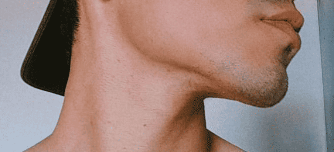 10 Different Types & Shapes Of Chin: A Comprehensive List| Mewing.coach