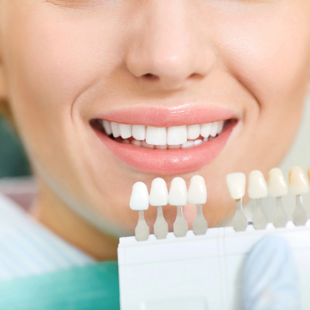 Cosmetic Dentistry Services| Mid North Coast Dental