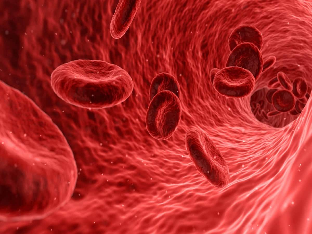 Blood Disorders - Pictures