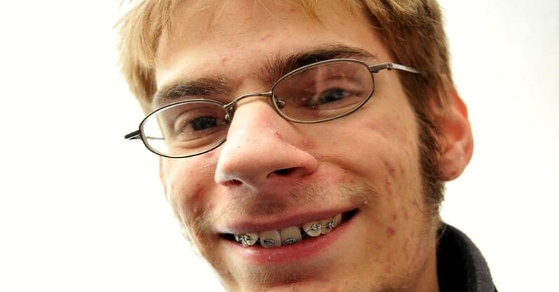 10 brutally honest tips to deal with being ugly (hint: perspective matters)