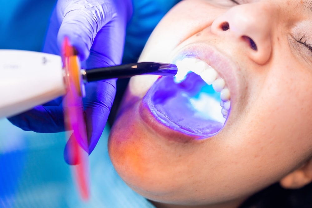 Dental Sealants In Anchorage | Health Centered Dentistry