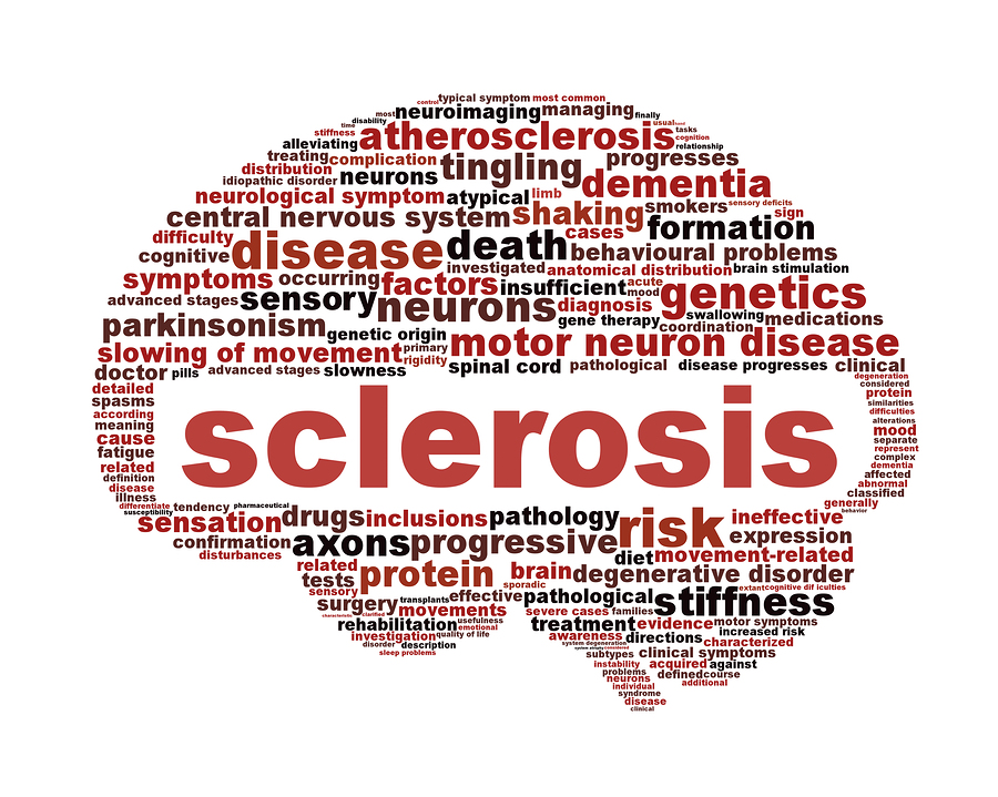 MS: When Your Own Immune System Attacks You. Read How Here | HealthWorks Malaysia